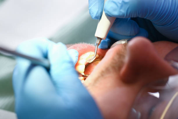 Best Emergency Treatment for Toothache in West Des Moines, IA