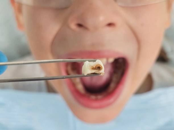 Best Pediatric Emergency Dentist in West Des Moines, IA